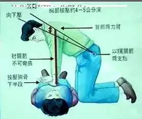 2015年國(guó)際新標(biāo)準(zhǔn)心肺復(fù)蘇術(shù)操作指南,流程 2015年國(guó)際新標(biāo)準(zhǔn)心肺復(fù)蘇術(shù)操作指南,流程